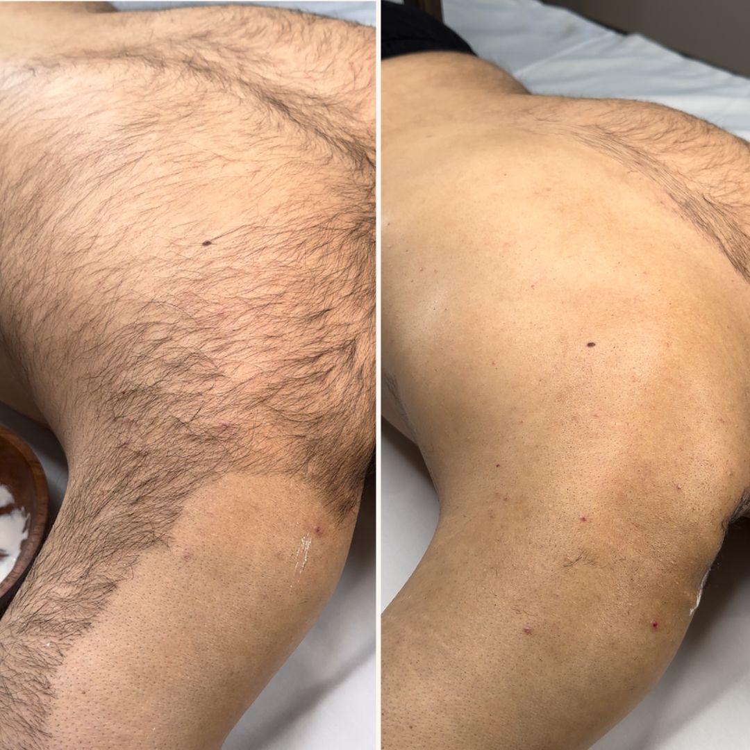 Body Hair Removal Powder