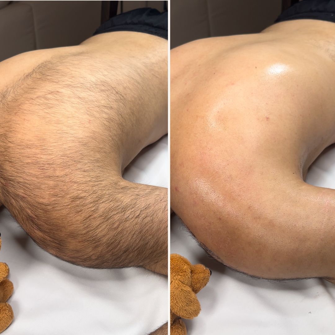 Body Hair Removal Powder